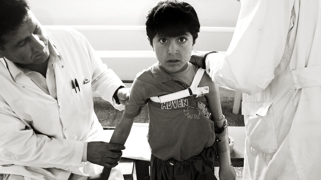 Giles Duley - Afghanistan Amputee - Photo via Channel 4